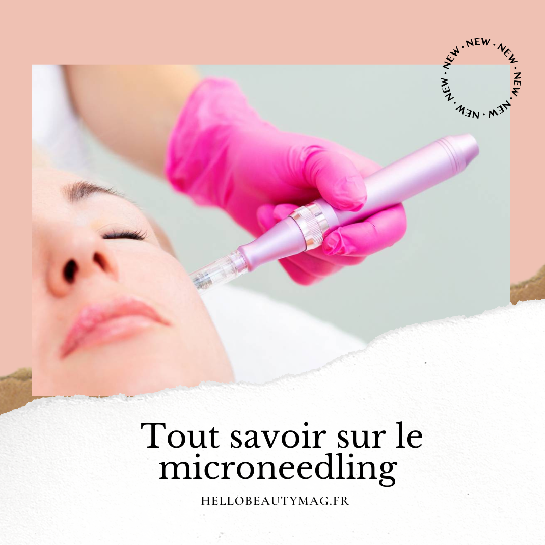 tout-savoir-sur-le-microneedling-